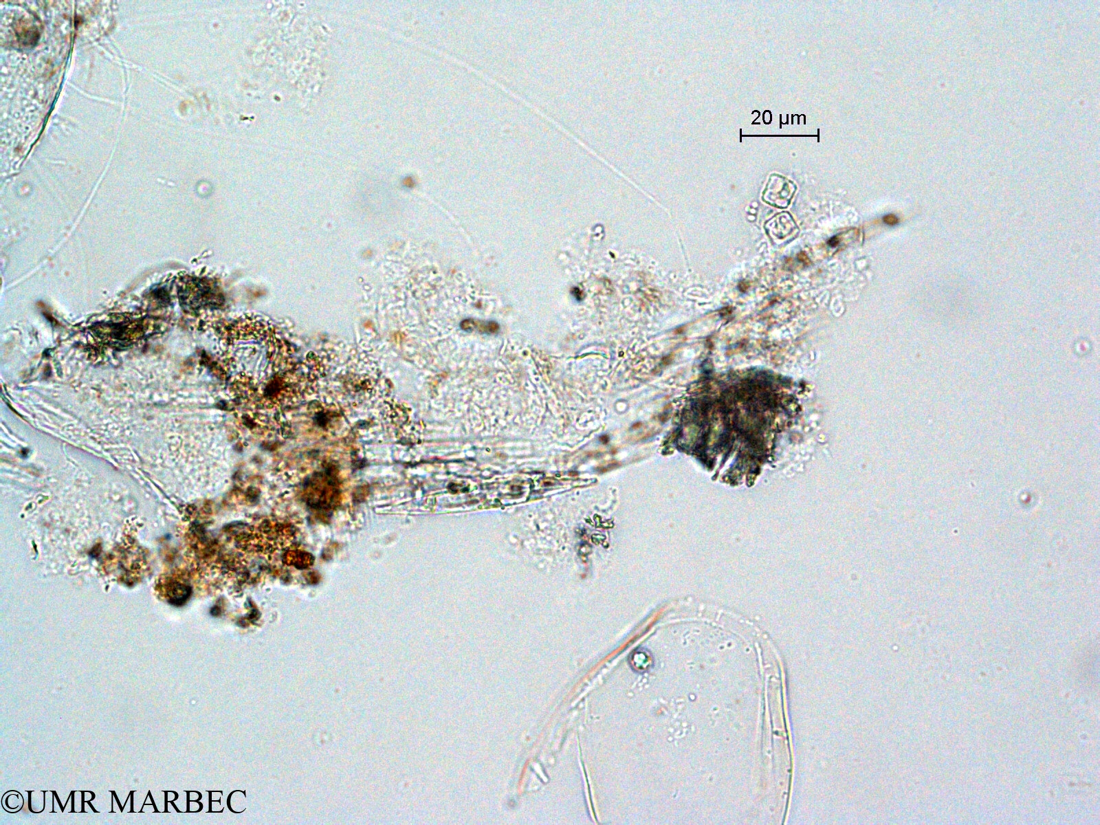 phyto/Scattered_Islands/all/COMMA April 2011/Bacillaria paxillifera (3)(copy).jpg